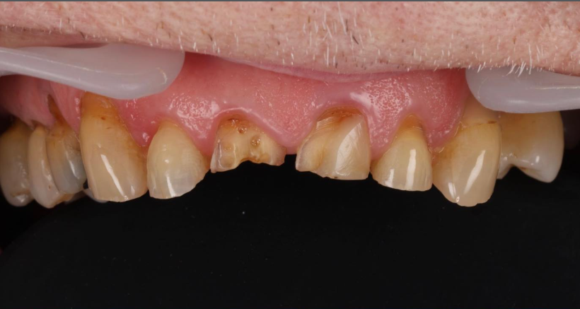 Case study before treatment