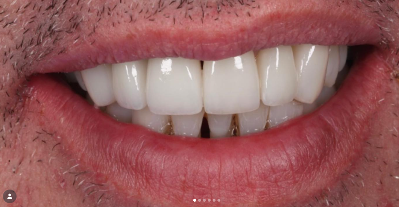 Case 3 after treatment