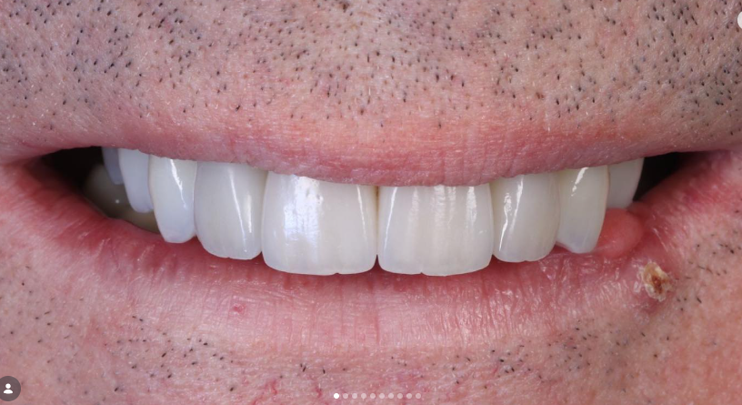 Case 4 after treatment